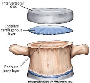 Anillo intervertebral 2025