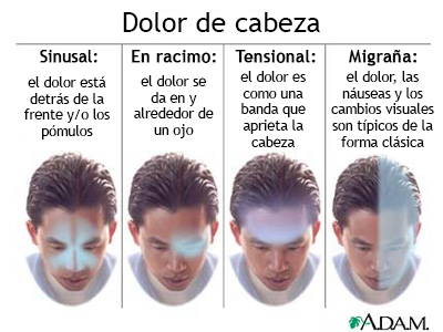 Dolor de cabeza de origen cervical - Prolive