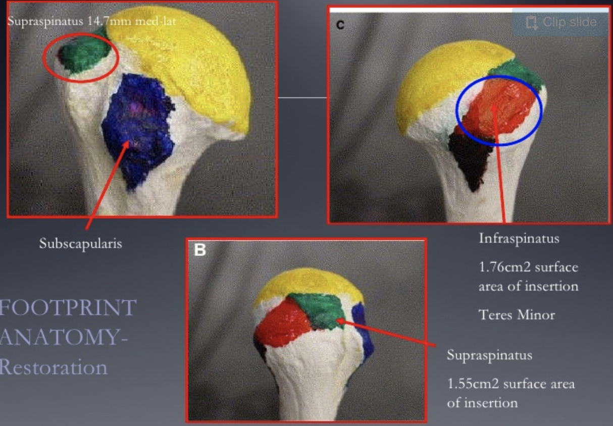 Is Early Physical Therapy Safe After A Rotator Cuff Repair