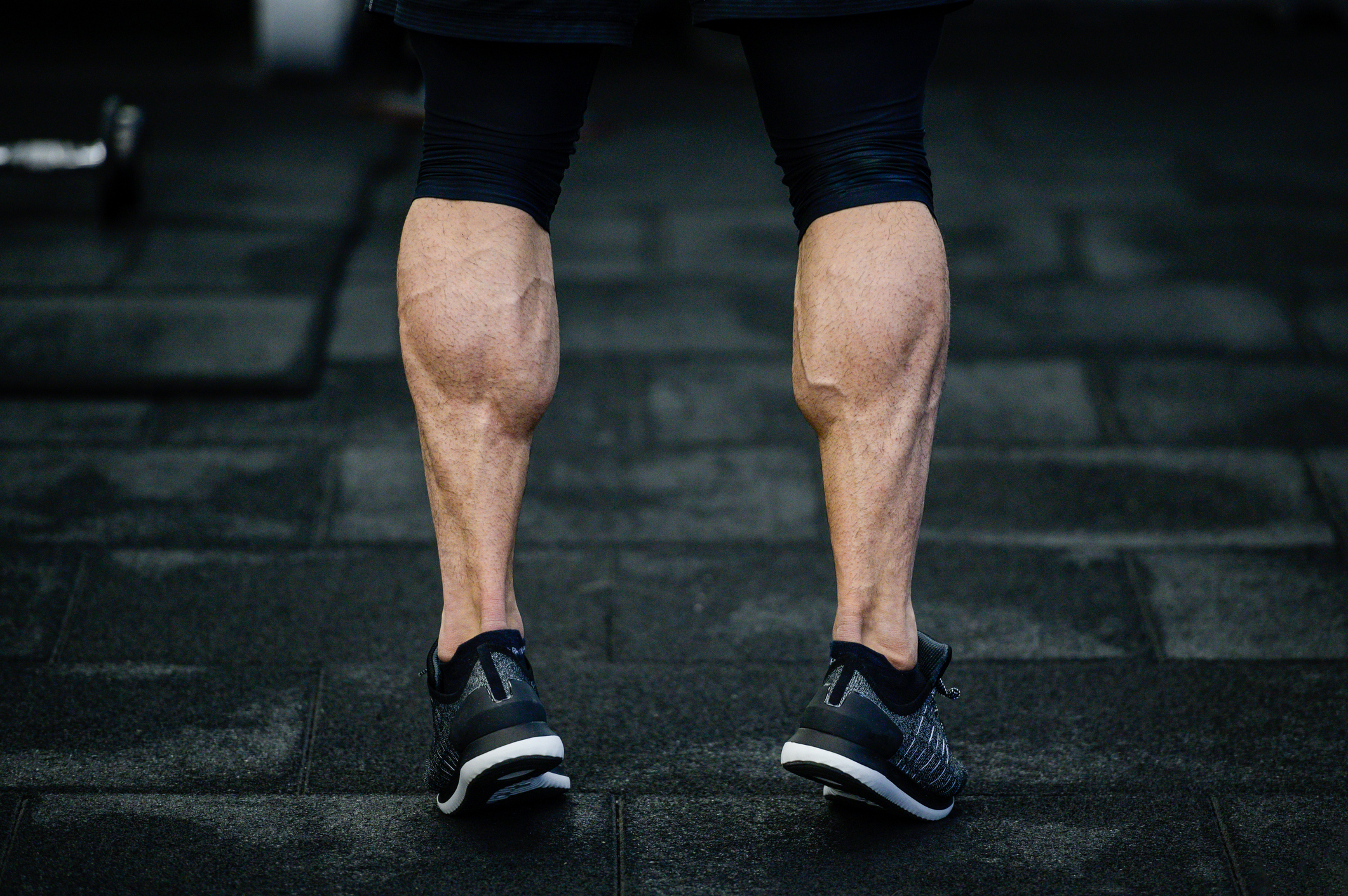 A calf strain can occur in either your gastrocnemius or soleus