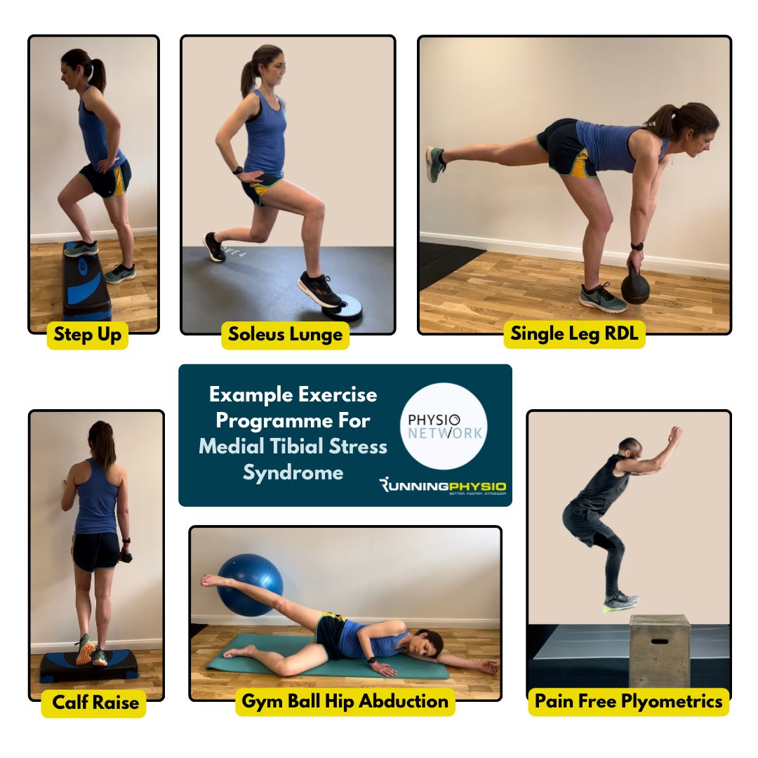 Exercises For Medial Tibial Stress Syndrome AKA Shin Splints Physio Network