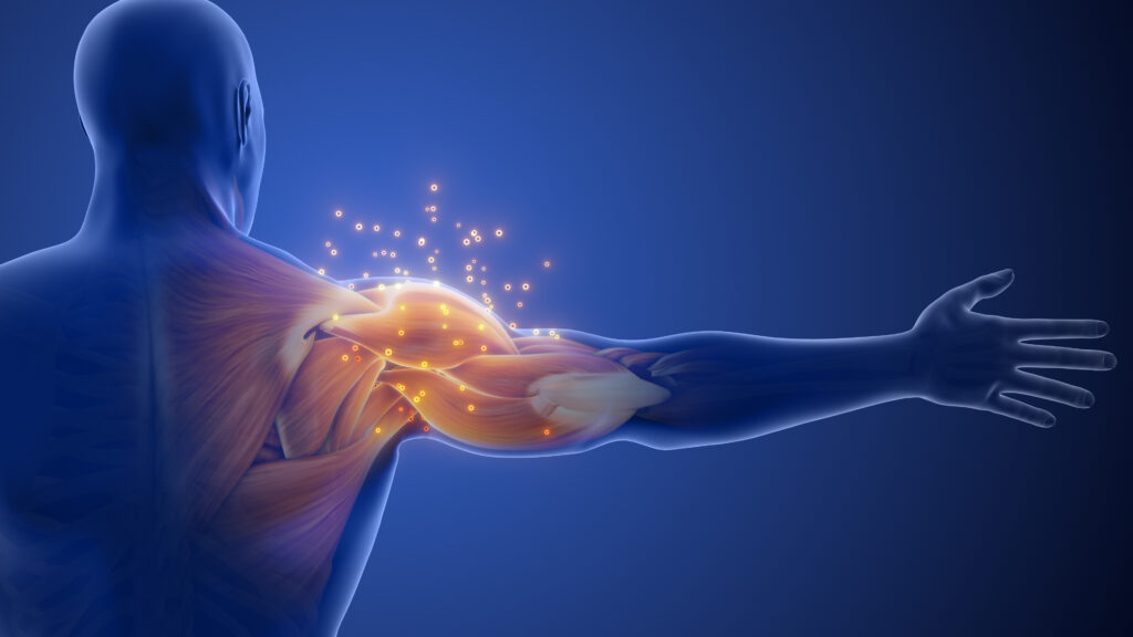 3 Common Mistakes In Shoulder Instability Rehab — Physio Network