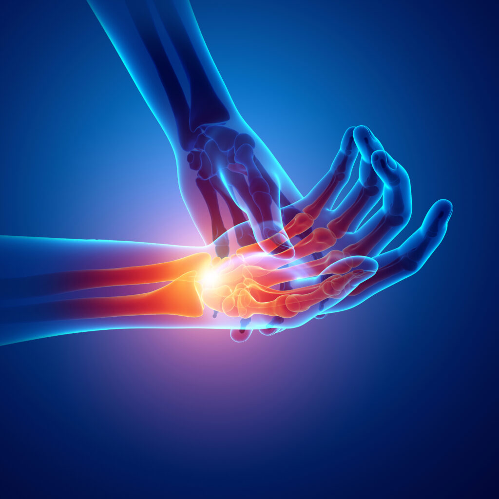 From Research To Practice: Triangular Fibrocartilage Complex (TFCC ...