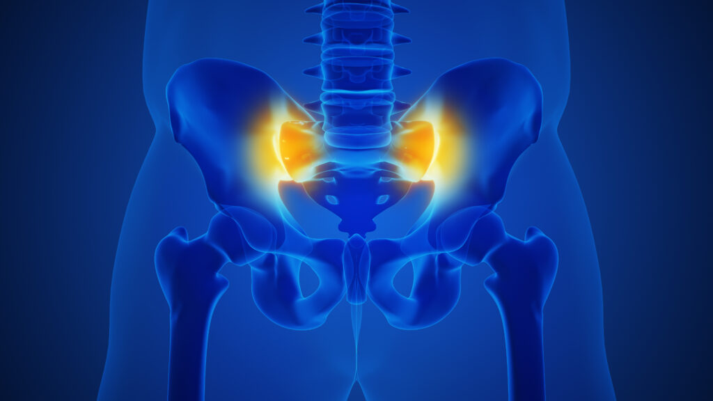 From Research To Practice: A Tricky Case Of SIJ Pain — Physio Network